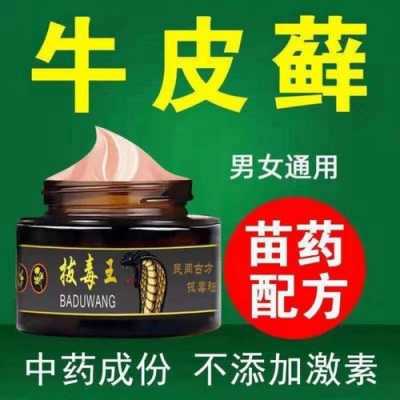 牛皮癬能用生姜泡酒擦癬嗎（牛皮廨可以用生姜片擦嗎）-圖1