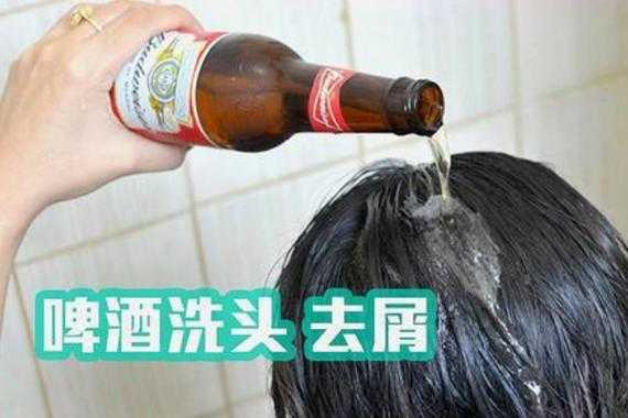 生姜米醋啤酒治白頭發(fā)（生姜醋啤酒洗頭發(fā)可以變黑嗎）