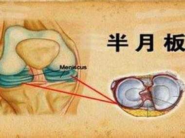 生姜對(duì)半月板的危害有多大（生姜治半月板損傷偏方）