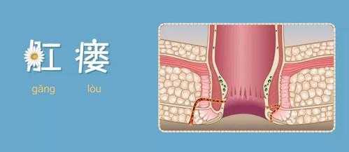 肛瘺能吃生姜蒜燒的菜嗎（肛瘺可不可以吃蔥姜蒜）-圖2