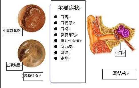 中耳炎可以吃大蒜和生姜嗎（中耳炎可以吃大蒜素嗎）-圖3