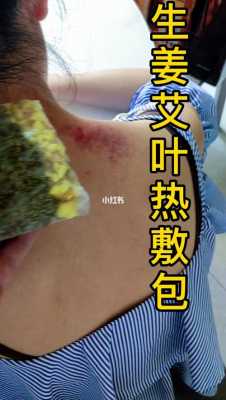 艾草和生姜外敷（艾草加生姜熱敷）-圖2