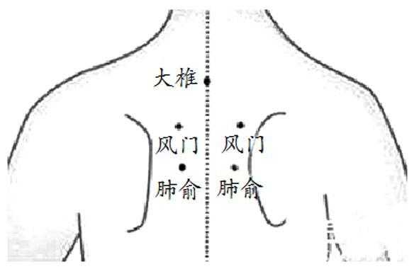 咳嗽用生姜擦背（咳嗽擦姜擦那部位）-圖2