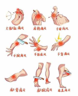 痛風似生姜的簡單介紹