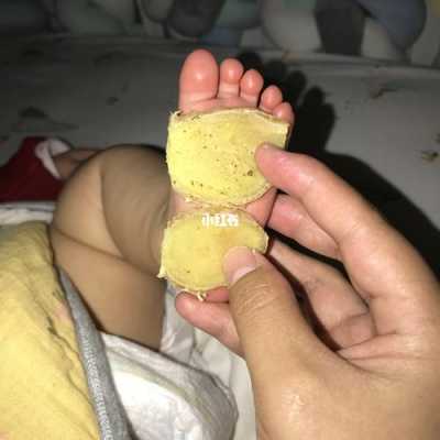 生姜腳心小兒