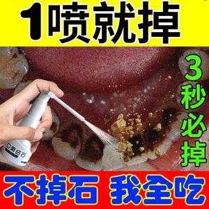 白醋和生姜怎么去除牙結石-圖2