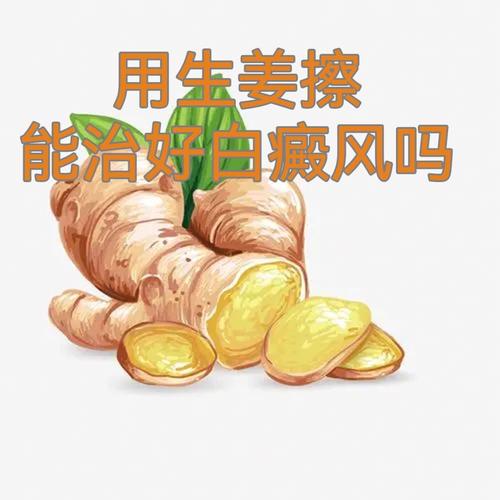 白癲風生姜治療的簡單介紹