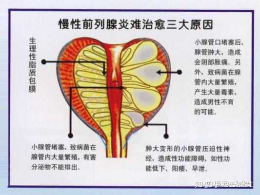 生姜治療前列腺炎的方法-圖3